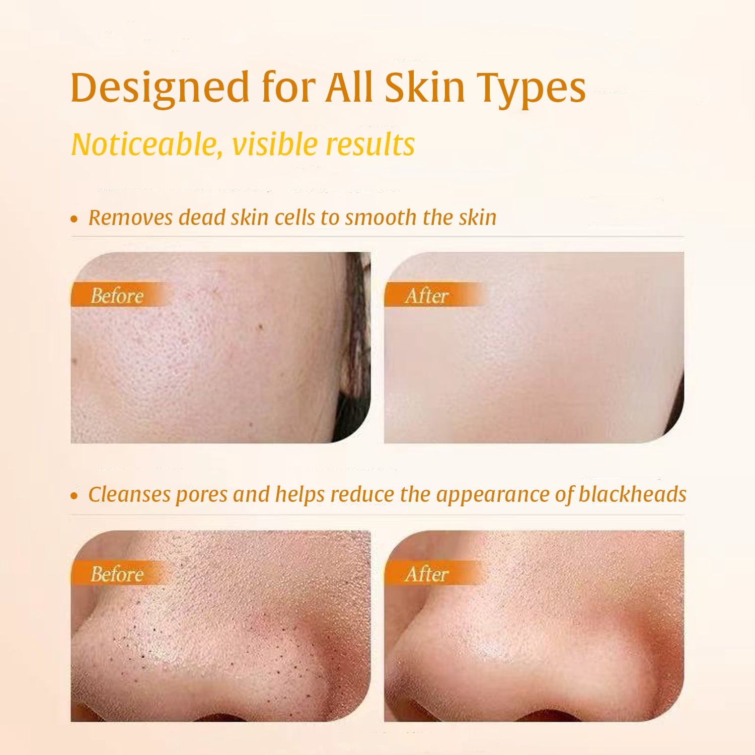 3-in-1 Turmeric & Kojic Acid Skincare Set – Exfoliating Gel Peel + Amino Acid Foam Cleanser + Gentle Soap for Dark Spot, Dead Skin Cells Remover, Skin Brightening, Even Tone