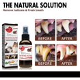 thumbnail image 3 of 1-3pcs Pet Tooth Cleaning Spray Oral Cleanse Dogs Cats Teeth Clean Deodorant Stain Removal Halitosis Cleaning Tool, 3 of 5