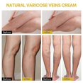 thumbnail image 4 of 60g Bee-Venom Anti-Varicose Soothing Cream, Advanced Vitamin K Cream Reduces Swelling Varicose & Spider Veins, 4 of 5