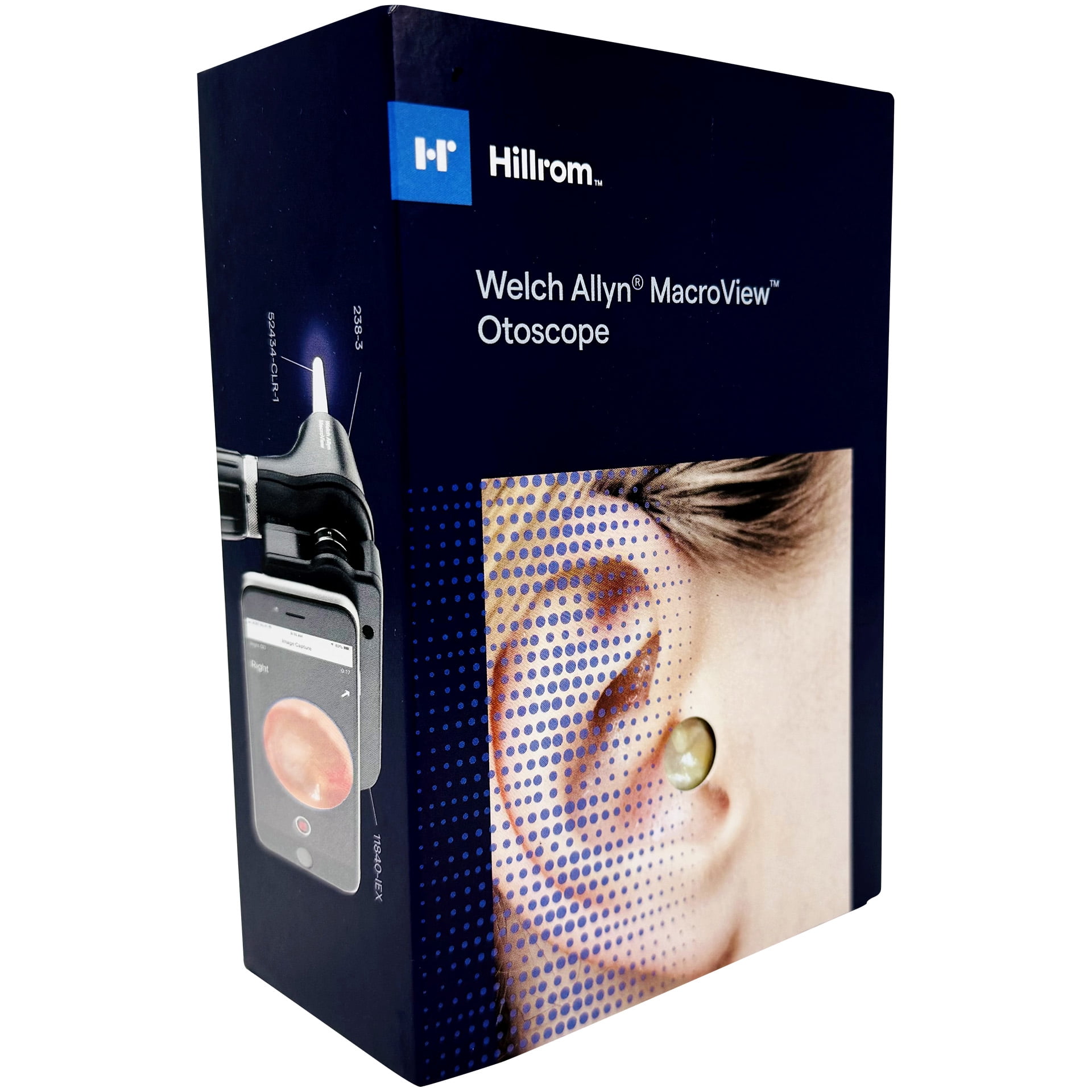 Welch Allyn 238-2 MacroView Basic LED Otoscope