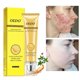 thumbnail image 2 of Crema blanqueadora para el cuidado facial OEDO Repair Acne, 20 ml con ginseng, 2 of 4