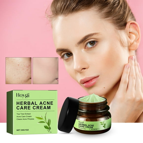 RKSTN Moisturizing Cream Herbal Antis-acnes Cream Fades Acnes Skin Closes Acnes Cleans Moisturizes And Smoothes The Face Moisturizer Face Cream