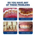 thumbnail image 5 of 2x Tartar Dissolving Oral Spray Anti-halitosis Tartar Lasting Fragrance Retention Dissolving And Removing Dental Calculus, 5 of 5