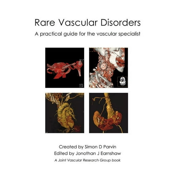 Rare Vascular Disorders: A Practical Guide for the Vascular Specialist (Hardcover)