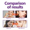 thumbnail image 5 of Alvantor Instant Face Lift Cream for Women, Moisturizing Cream For Wrinkled Skin , 1fl.oz, 5 of 7