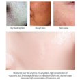 thumbnail image 4 of Crema retráctil de poros con ácido salicílico, eliminación rápida de poros grandes, eliminación de puntos negros, estiramiento de la cara, piel suave, producto coreano para el cuidado, 4 of 5