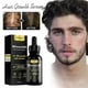 thumbnail image 1 of Mejor Belleza 5% Minoxidil Hair Growth for Men and Women - Infused with Biotin, Niacinamide and Panthenol, Prevent Hair Loss, 1 of 8