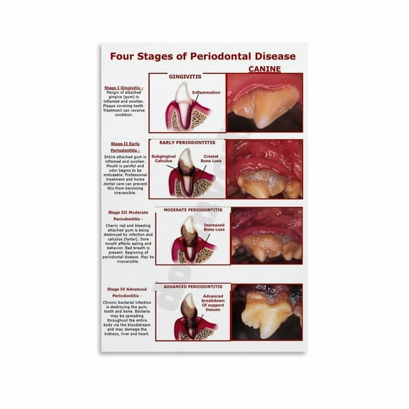 Four Stages of Periodontal Disease in Dogs Poster Animal Dental Hospital Poster Canvas Painting Posters And Prints Wall Art for Living Room Bedroom Decor