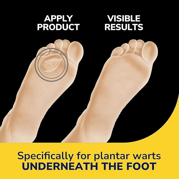 Dr. Scholl's Clear Away Plantar Wart Remover and Cushioning Bandages, 12 Count, Maximum Strength Treatment