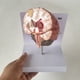 thumbnail image 5 of Modelo de Enfermedad del Cerebro Humano - Patología Cerebral Hemorragia del Encefálico Modelo de Enseñanza Médica - Modelo de Anatomía del Cerebro Humano, 5 of 5