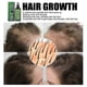 thumbnail image 4 of 100ml Hair Growth Spray Hair Growth Lotion Spray Hair Salon Hair Repair, 4 of 5