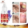 alextreme 10Ml Nail Fungus Treatment Anti Fungal Toenail Repair Care Lavender Essential Oil