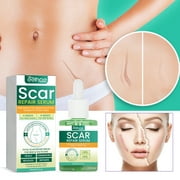 Scar Guards Repair Liquid | Oil for Scar Removal And Repair - 30ml Scar Repair Smoothing for Reducing Scars Pregnancy Scar