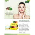 thumbnail image 2 of Vaadi Herbals Anti Acne Cream, (Clove and Neem Extract) - 30g, 2 of 2