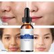 thumbnail image 1 of Suero facial con esencia de ácido hialurónico, hidratante, cuidado de la piel, crema blanqueadora de belleza coreana, crema reparadora y nutritiva con caracol, 1 of 6