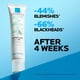 thumbnail image 5 of La Roche-Posay Effaclar DUO (+) M Crema hidratante anti-imperfecciones, 40ml, 5 of 6