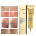 thumbnail image 1 of Crema para eliminar cicatrices de acné, gel para cicatrices, crema facial para reparar manchas de acné, tratamiento para el acné, cuidado de la piel, blanqueamiento de estrías, 1 of 5