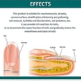 thumbnail image 5 of 1-3X 2025 Nailner Brush Against Nail Fungal Infection 2 in1 treat & brighten nails, 5 of 5