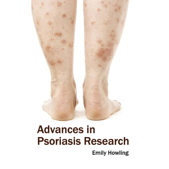 Advances in Psoriasis Research, (Hardcover)