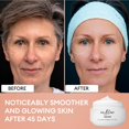 thumbnail image 3 of Crema Hidratante Inblair Elevate SPF15 Niacinamida 50 ml, 3 of 7