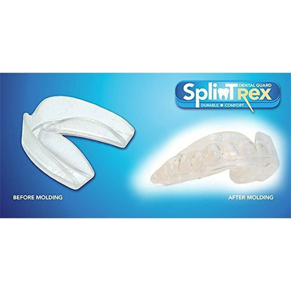 Professional Teeth Mouth Guards for Teeth Grinding and Clenching