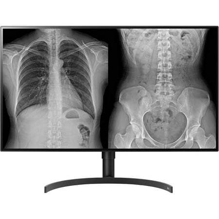 UPC: 0719192634541 | LG 32HL512D-B 32  Class 4K LCD Monitor  16:9  TAA Compliant