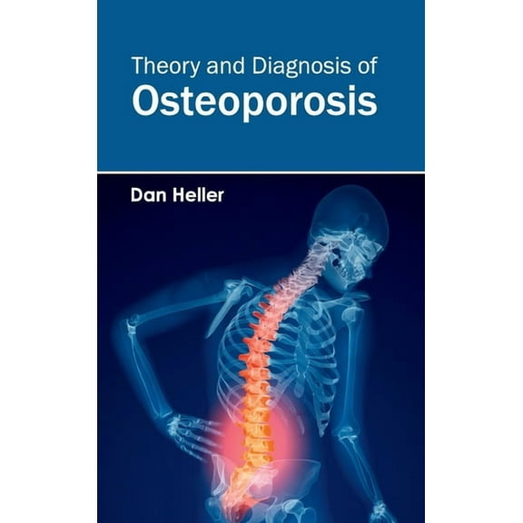 Theory and Diagnosis of Osteoporosis, (Hardcover)