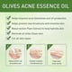 thumbnail image 4 of Jaysuing essential oil to face oily acne mild moisturizing a - 30ml, 4 of 5