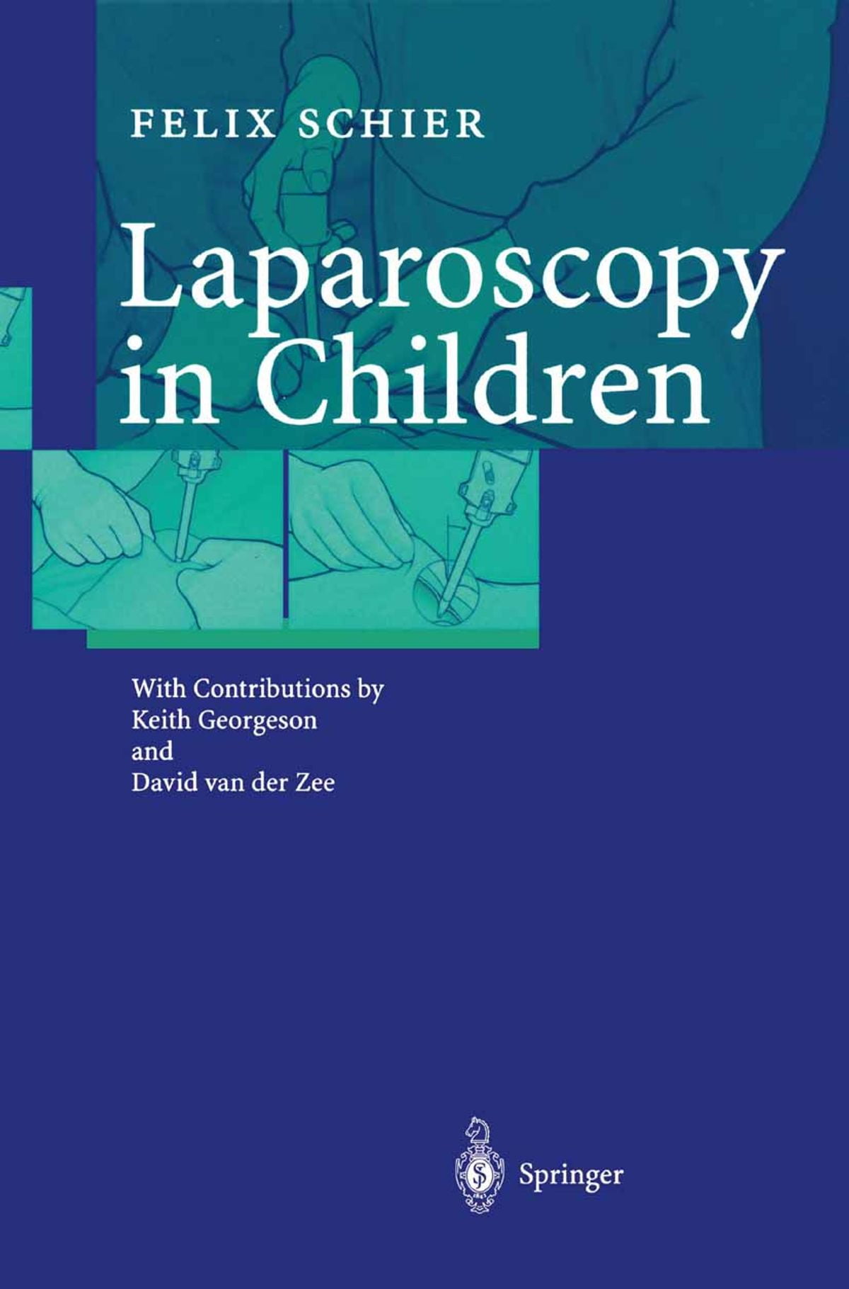 Is This The Cpt Code You Need For Exploratory Laparoscopy? - m54om2e