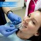 thumbnail image 3 of 10 Uds. Boquilla azul separador de mejillas tipo C blanqueamiento de dientes desafío de apertura, 3 of 5
