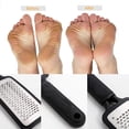 thumbnail image 4 of Foot File Callus Remover,Professional Foot Scrubber Pedicure Kit,Surgical Grade Stainless Steel File, 4 of 5