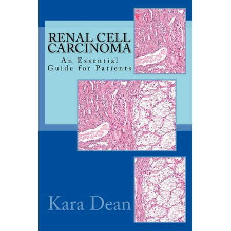 Renal Cell Carcinoma: An Essential Guide for Patients -