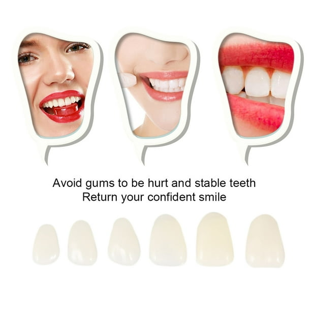 1 caja de carillas dentales temporales de porcelana para dientes molares delanteros y traseros
