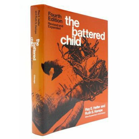 Pre-Owned The Battered Child (Hardcover) 0226326314 9780226326313