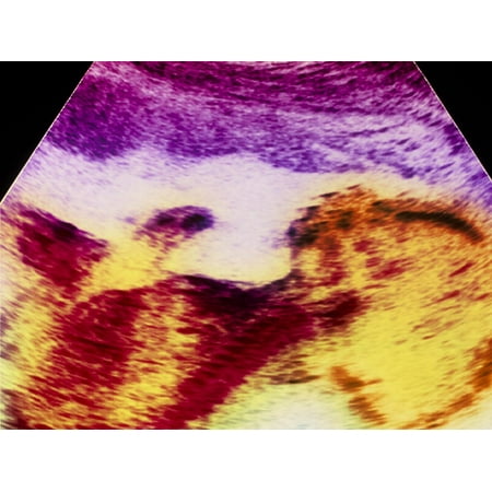 Ultrasound Scan of 20 Week Old Foetus (side View) Print Wall Art By Science Photo (Best Scanner To Scan Old Photos)