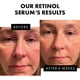 thumbnail image 5 of IBeaLee Retinol Muscle Tightening face cream Vitamin E Moisturizing, Nourishing, Wrinkle Resisting and Repairing face cream, 5 of 5