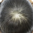 thumbnail image 4 of LYRICAL HAIR Mens Hair System Durable Fine Mono Center Mens Toupee Human Hair Replacement Thin Skin Toupee for Men Bleached Knots Toupee Hair for Man Black Brown Blonde Gray Hair Piece, 4 of 6