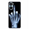 thumbnail image 4 of For ZTE Axon 40 LITE Case Popular Picture Black Silicone Soft Back Cover Case For ZTE Axon 40 Lite Case 40Lite Phone Cover Coque B06.CH.128 For ZTE Axon 40 LITE, 4 of 6