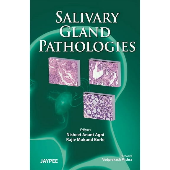 Salivary Gland Pathologies (Paperback)