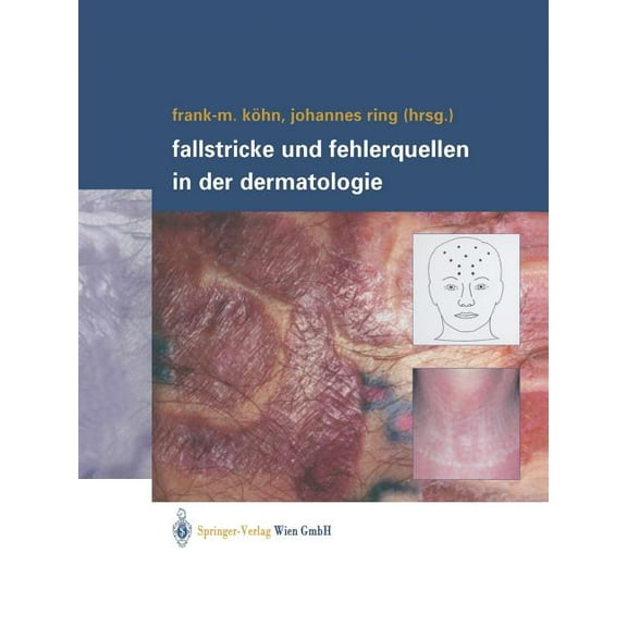 Fallstricke Und Fehlerquellen in Der Dermatologie, (Paperback)