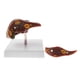 thumbnail image 1 of Modelo Patológico de Hígado Yotijar Herramienta de Enseñanza, 1 of 7