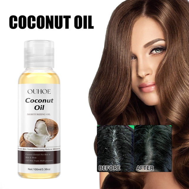 Aceite de coco, aceite corporal blanqueador e hidratante, aceite vegetal, extracto de nuez, esencia hidratante de 100 ml.