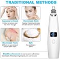 thumbnail image 4 of Face Blackhead Vacuum Cleaner, Professional Blackhead Vacuum Cleaner With LED Display, 3 Modes(White), 4 of 5