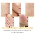 thumbnail image 3 of 2pcs Turmeric Cleansing Pad Deeply Cleanses Skin, Removes Dirt, Controls Oil And Softens Exfoliated And Tender Ski, 3 of 5