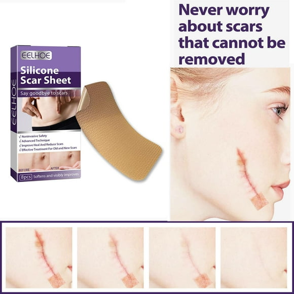 Cintas para cicatrices Colcomx de silicona