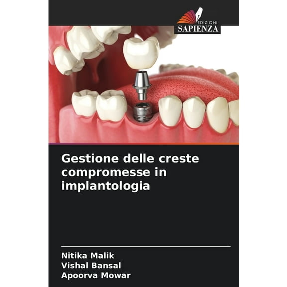 Gestione delle creste compromesse in implantologia, (Paperback)