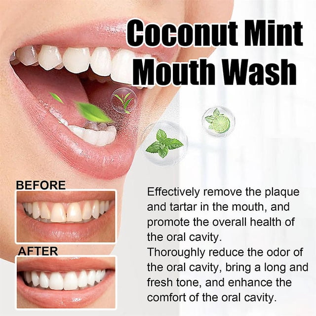1-3pcs Oil Pulling Coconut and Peppermint Oral Health, Healthy Teeth Gums, Mouthwash Alcohol Free, Whitening, Helps Bad Breath Freshens Mouth