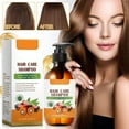 thumbnail image 1 of Fiudx Champú Nutritivo, Fórmula Suave con Aceite de Árbol de Té, Solución Anticaspa, Mejora La Elasticidad Del Cabello, Uso Diario, Todo Tipo de Cabello, 300 Ml, 1 of 6