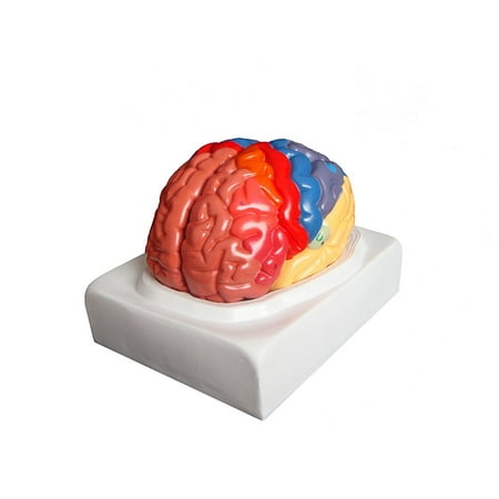 Vision Scientific Regional Brain Model - 2 Parts