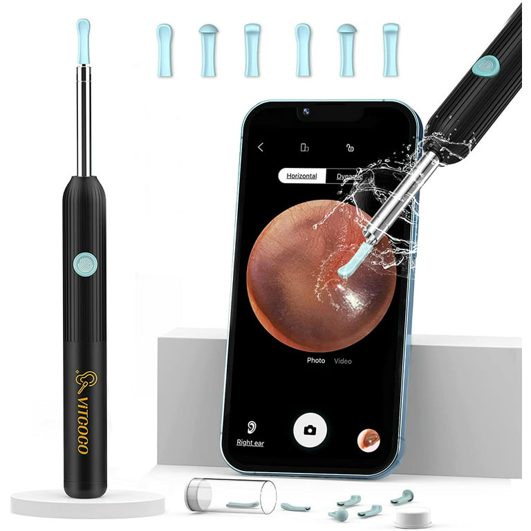 Noyafa Ear Wax Removal Kit with Ear Camera and 6 LED Lights, Ear Pick with  6 Reusable Replacement Soft Ear Scoops Y10 Pro